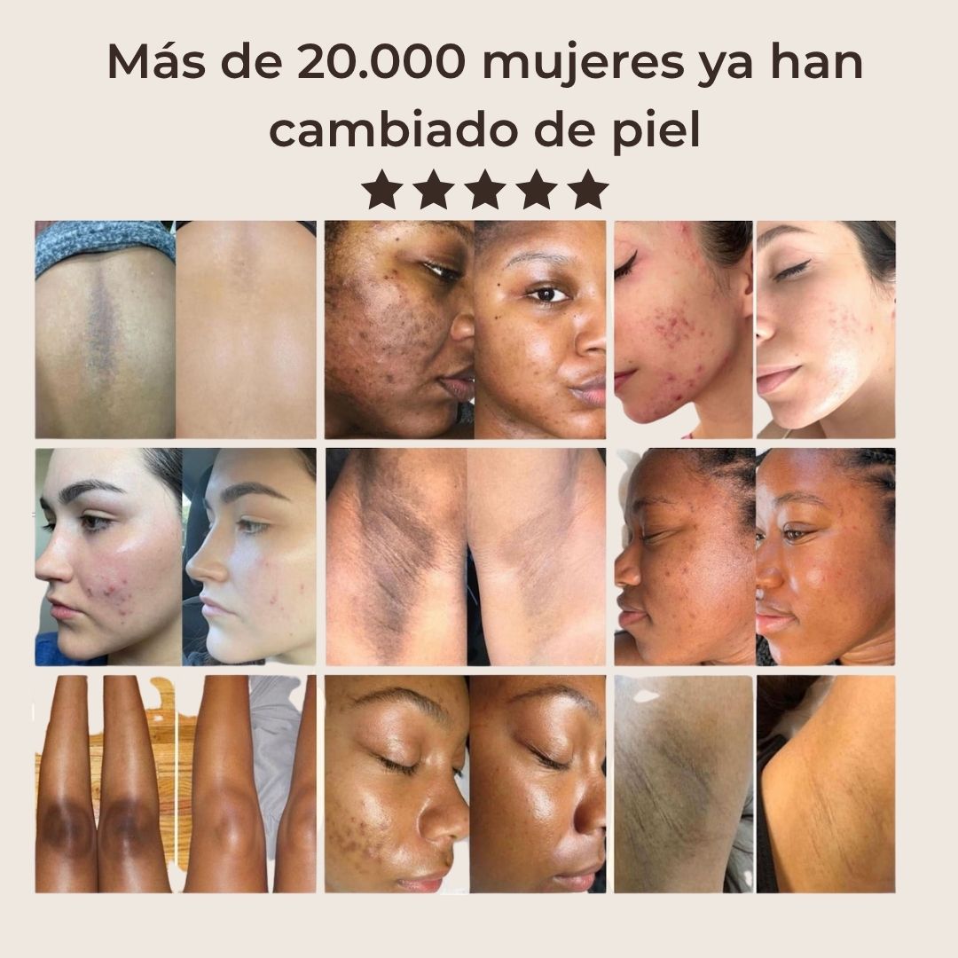 Pads anti-imperfecciones naturales (Curcumina + Ácido Kójico)