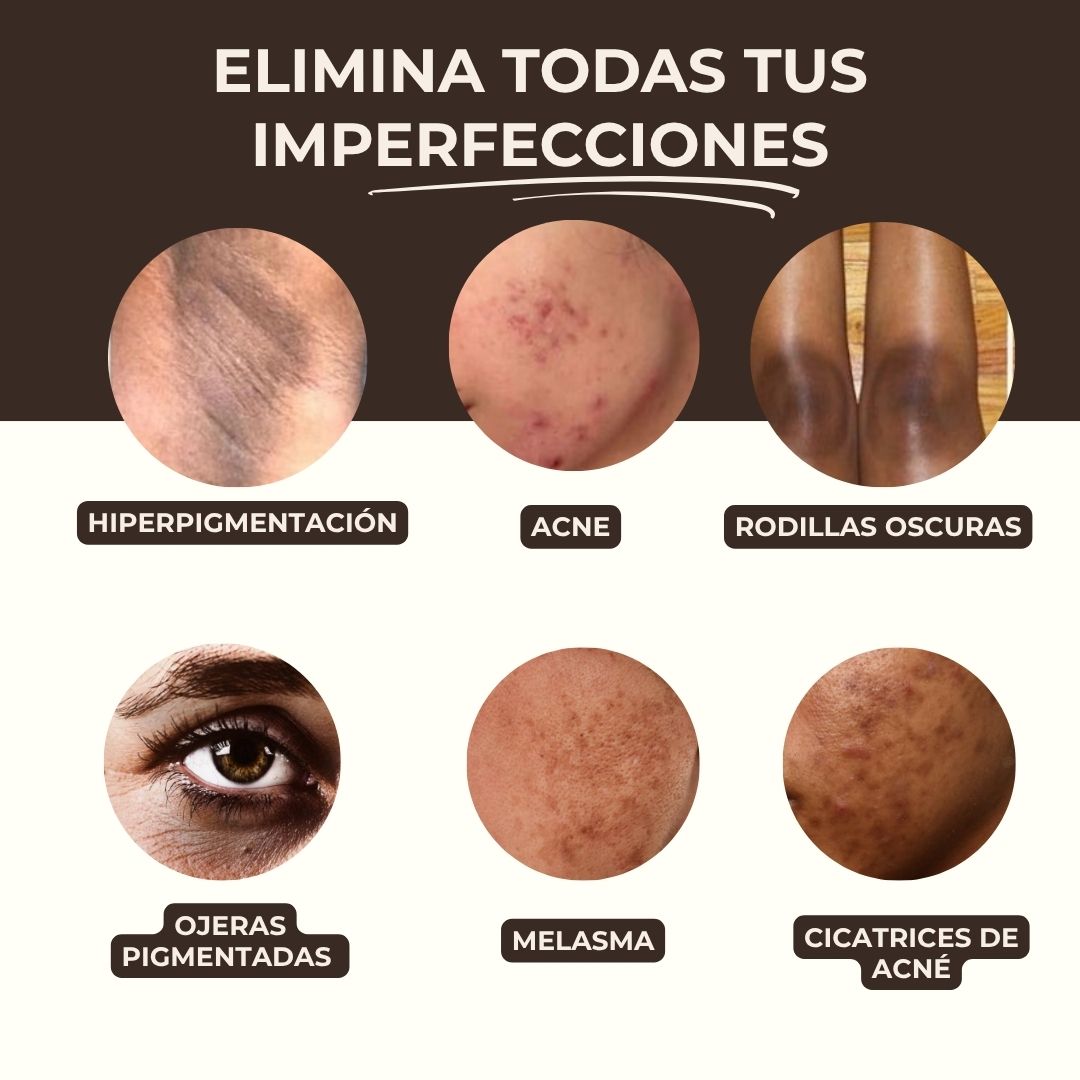 Pads anti-imperfecciones naturales (Curcumina + Ácido Kójico)