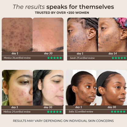 Pads anti-imperfecciones naturales (Curcumina + Ácido Kójico)